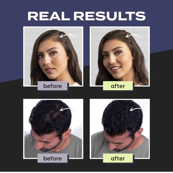 Toppik  keratin hair fibers 27.5g available in all colors price drop - Picture 6 of 15